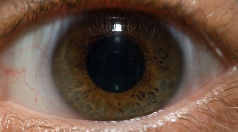 Macro close-up of a human eye with a hazel iris, illustrating the Life Biosciences ER-100 trial