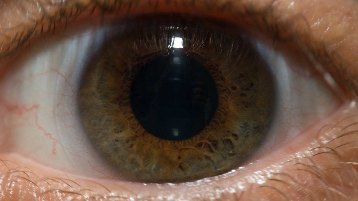 Macro close-up of a human eye with a hazel iris, illustrating the Life Biosciences ER-100 trial